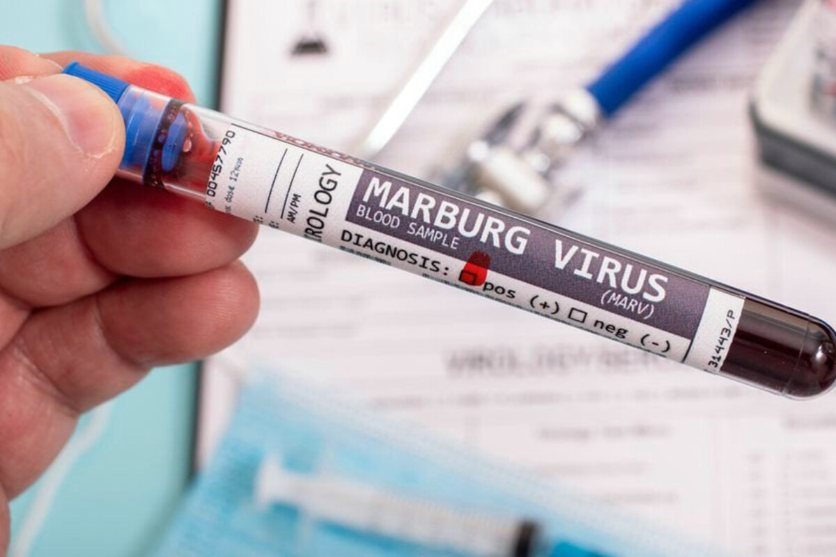 <p>ÜST Marburq virusunun epidemiya təhlükəsi barədə xəbərdarlıq edir</p>