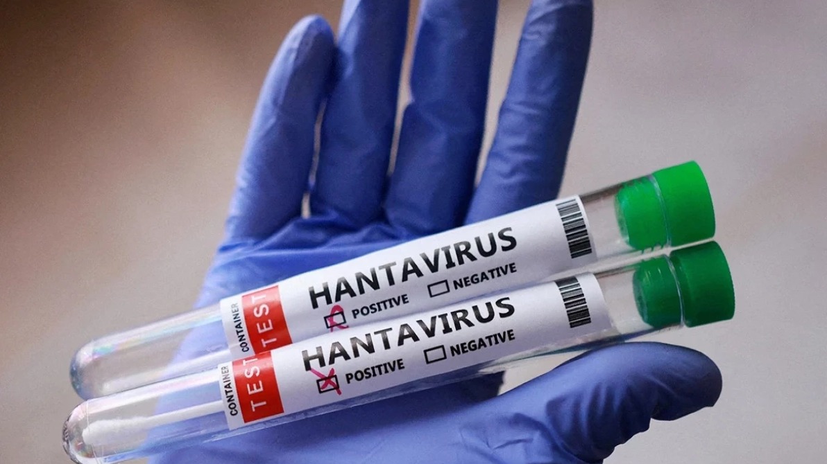 <p>Daha bir kruiz gəmisi sərnişinində hantavirus testi müsbət çıxıb</p>